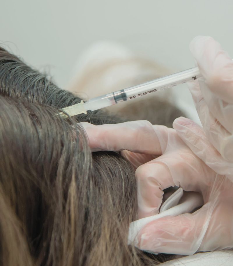 Acceso a terapias avanzadas para alopecia areata en clínica de referencia Acceso a terapias avanzadas para alopecia areata en clínica de referencia
