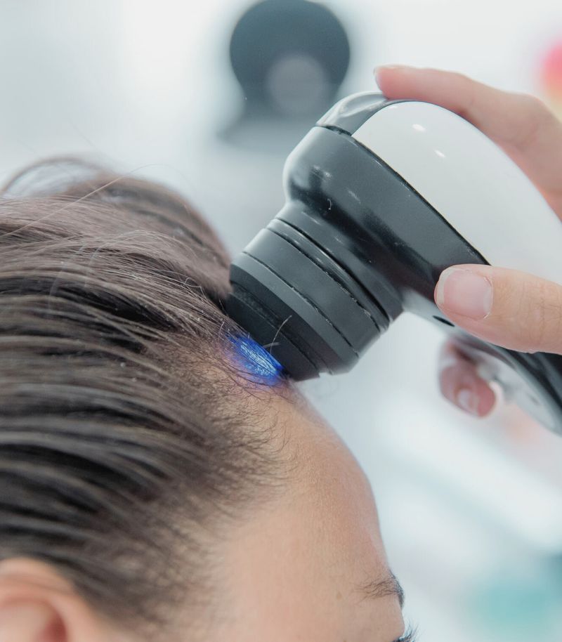 Clínica con experiencia clínica e investigadora en alopecia frontal fibrosante Clínica con experiencia clínica e investigadora en alopecia frontal fibrosante