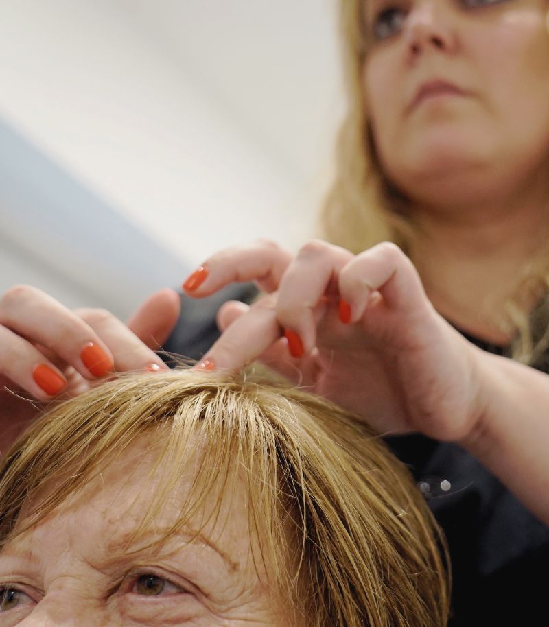 Advanced cosmetic solutions for frontal fibrosing alopecia