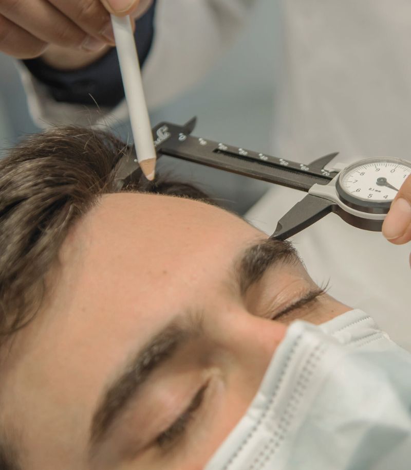 Soluciones capilares para alopecia masculina con tecnología regenerativa Soluciones capilares para alopecia masculina con tecnología regenerativa