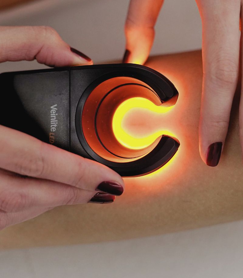 Innovación en tratamientos para angiomas con tecnología láser avanzada Innovación en tratamientos para angiomas con tecnología láser avanzada