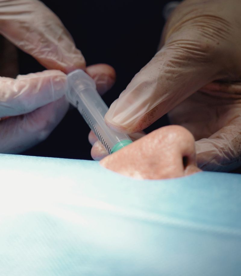 Mohs surgery with preservation of aesthetic and functional outcomes