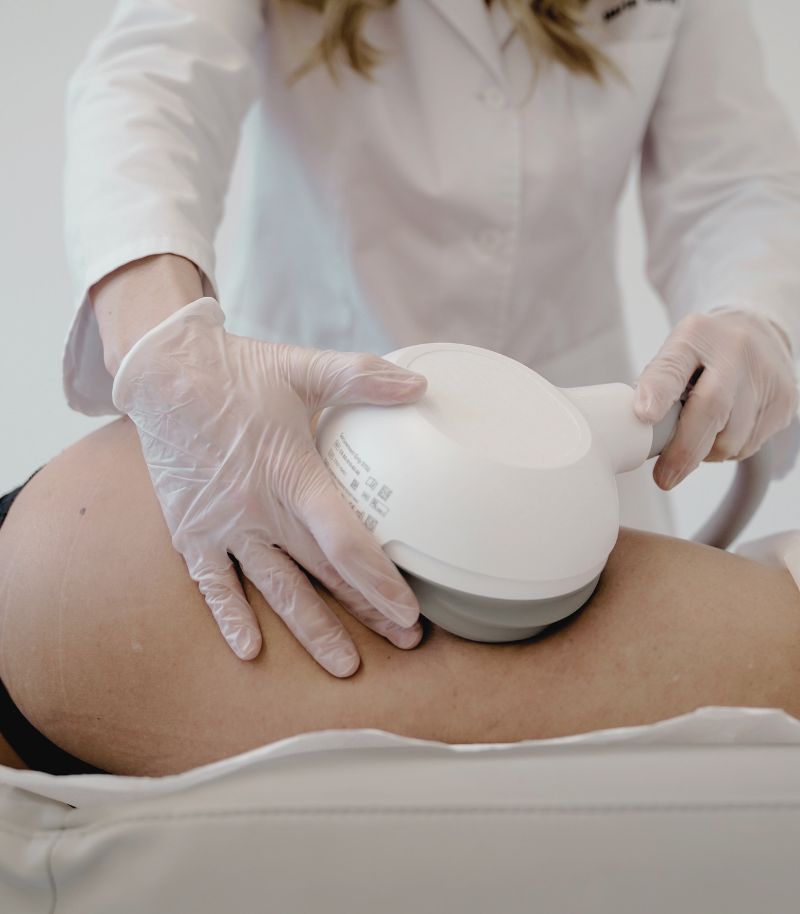 Criolipólisis para reducir grasa localizada con frío controlado y resultados visibles Criolipólisis para reducir grasa localizada con frío controlado y resultados visibles