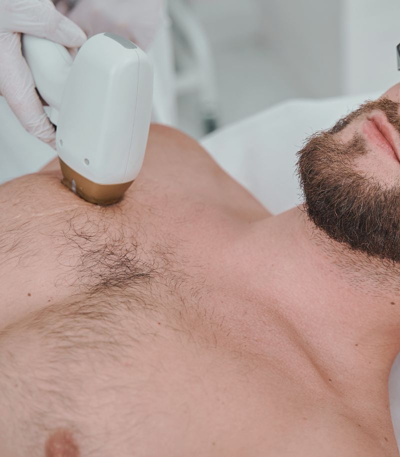 Depilación láser adaptada al vello y la piel masculina Depilación láser adaptada al vello y la piel masculina