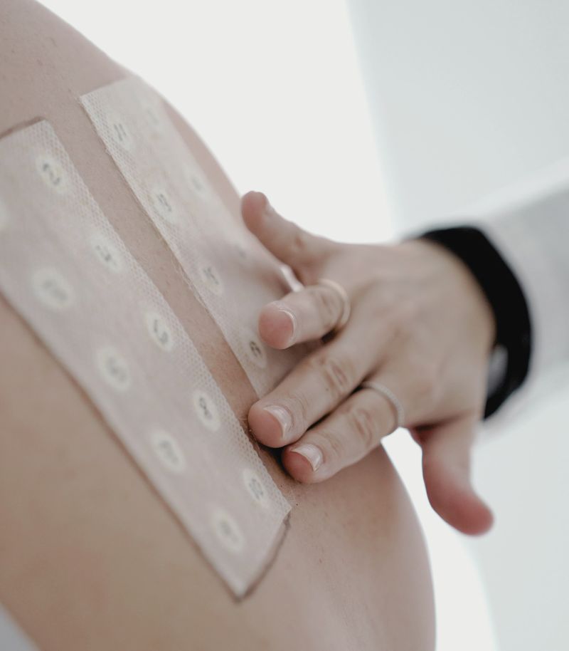 Tratamiento de dermatitis atópica infantil con enfoque respetuoso y eficaz