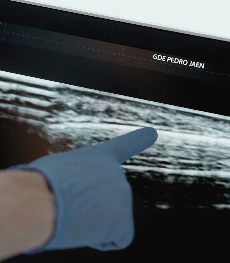 Ecografía capilar para evaluar la salud del cuero cabelludo en profundidad Ecografía capilar para evaluar la salud del cuero cabelludo en profundidad