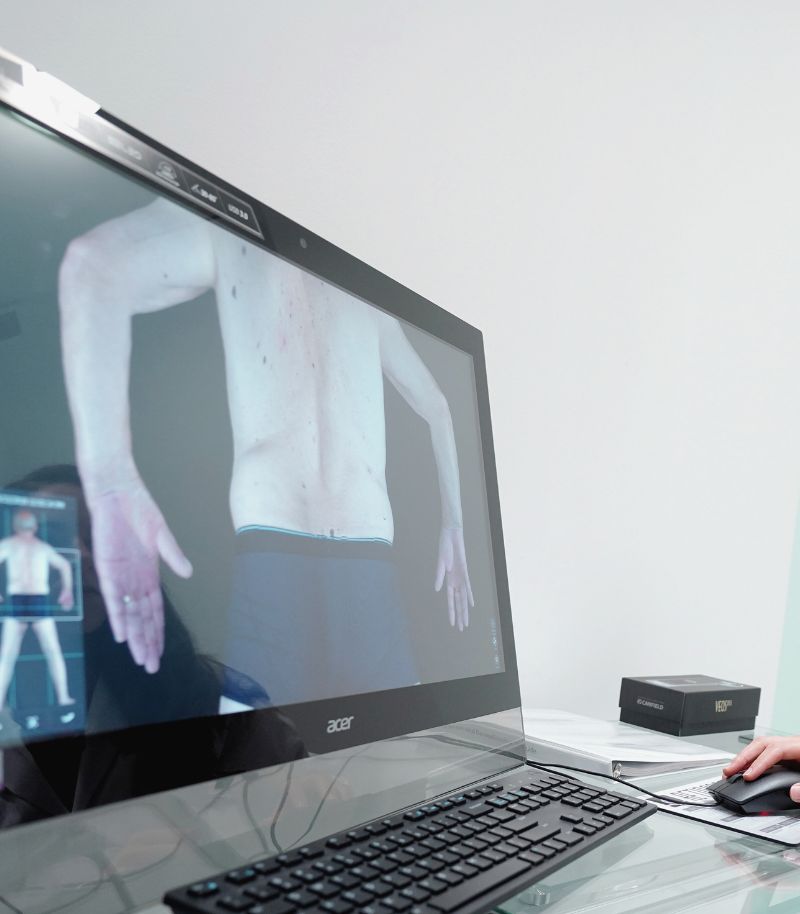 Exploración completa de la piel con tecnología Vectra 360 sin molestias