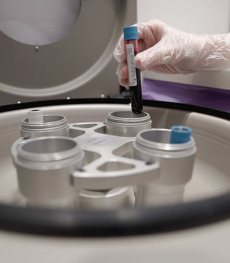 Terapias innovadoras y cuidado continuo en pacientes con hidrosadenitis supurativa Terapias innovadoras y cuidado continuo en pacientes con hidrosadenitis supurativa