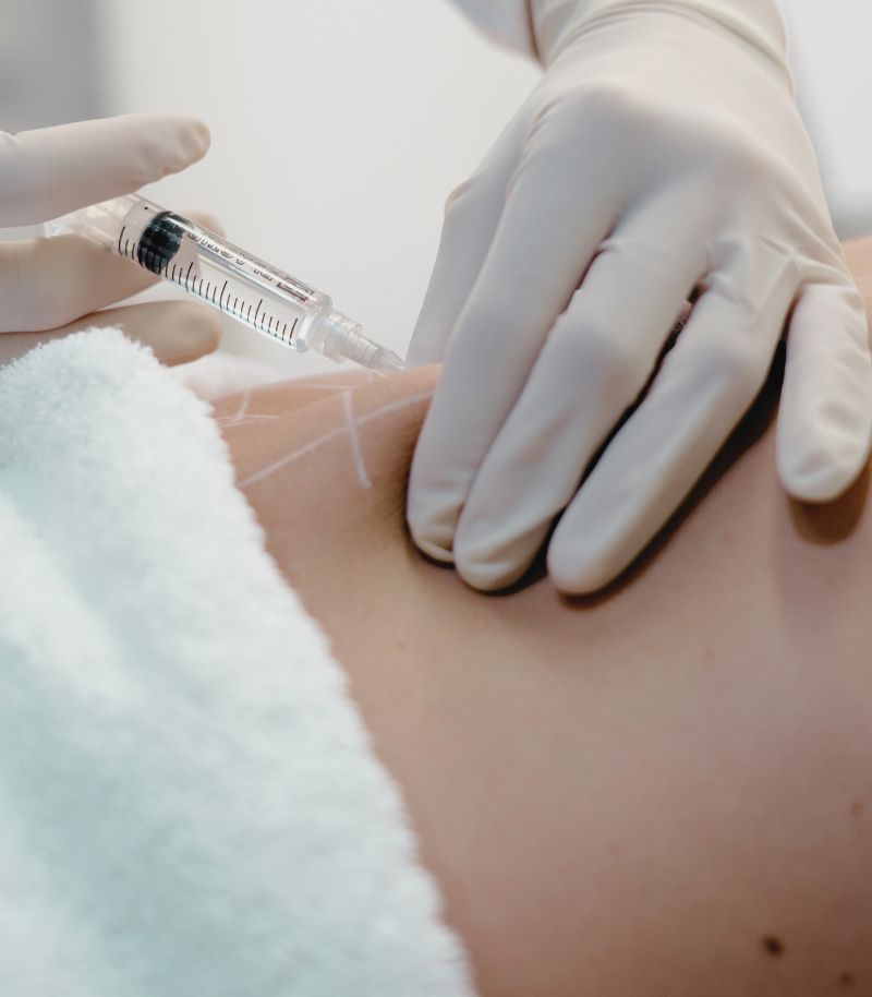 Uso de inductores de colágeno para tratar la flacidez corporal de forma efect