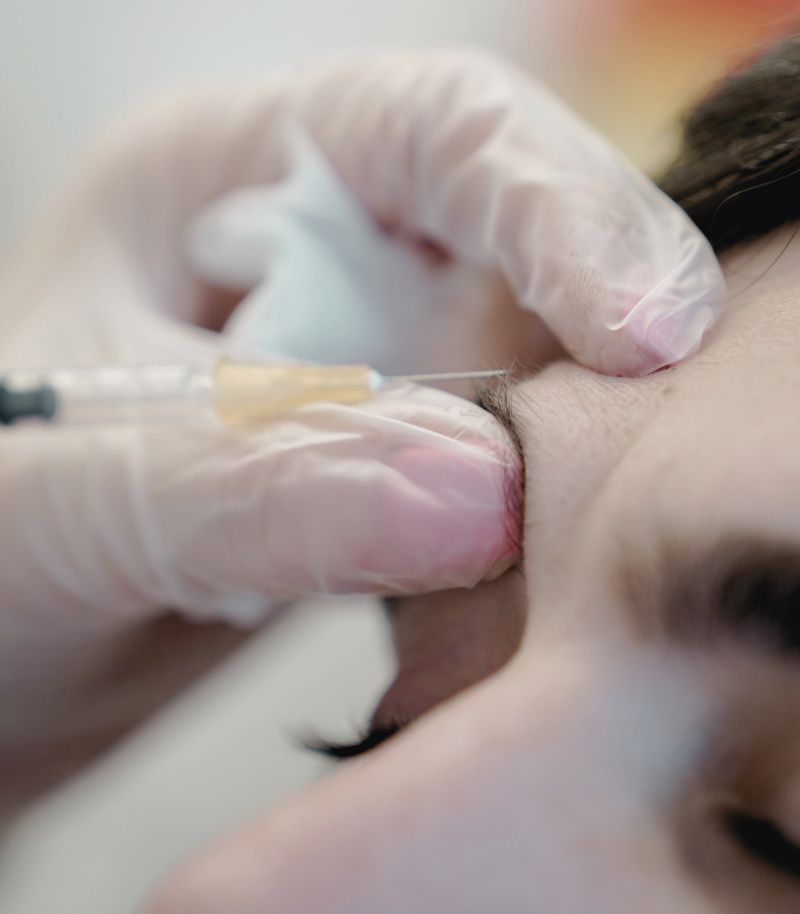 Estimulación de colágeno con inductores infiltrados para una piel más firme Estimulación de colágeno con inductores infiltrados para una piel más firme