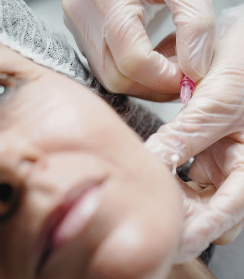 Tratamientos infiltrados para mejorar la calidad de la piel del cuello y escote Tratamientos infiltrados para mejorar la calidad de la piel del cuello y escote