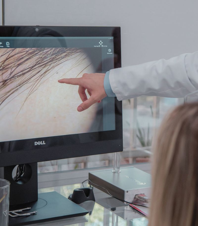 Resultados duraderos y estéticos en trasplante de cejas con técnica avanzada Resultados duraderos y estéticos en trasplante de cejas con técnica avanzada