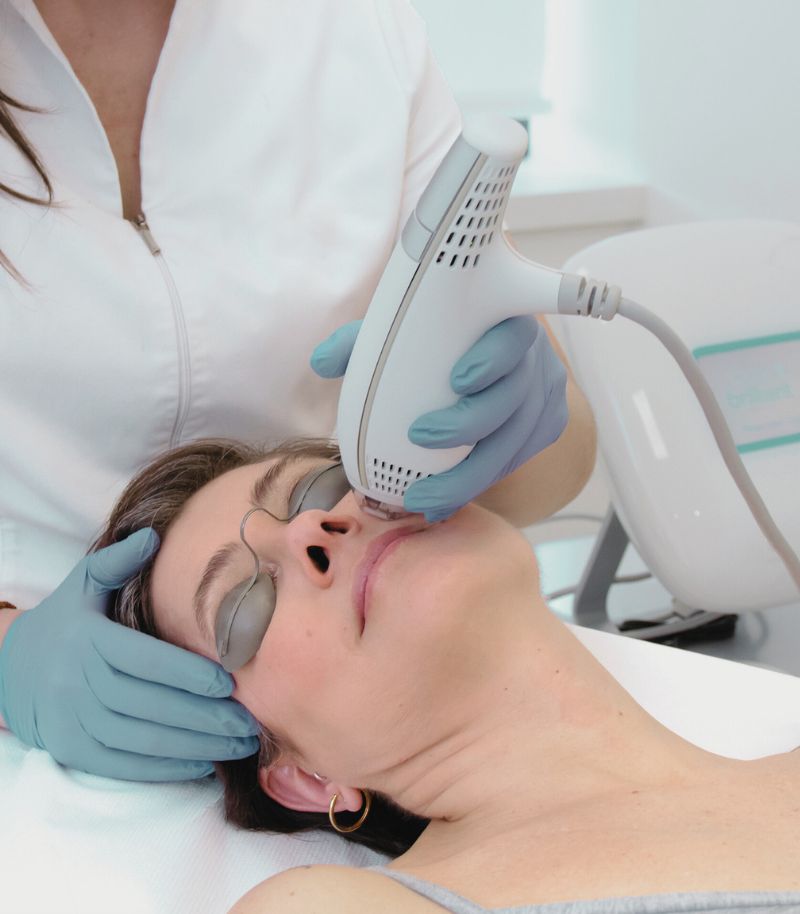 Preventive laser treatments to stimulate collagen and maintain firm, healthy skin