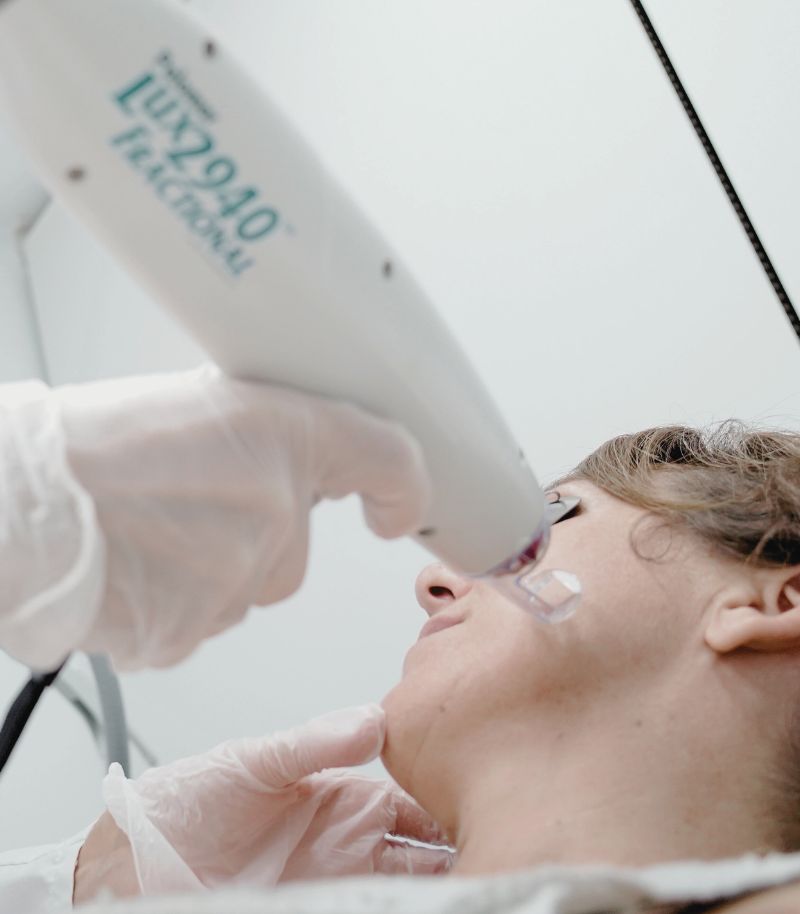 Láser fraccional para revitalizar la piel y tratar el envejecimiento facial Láser fraccional para revitalizar la piel y tratar el envejecimiento facial