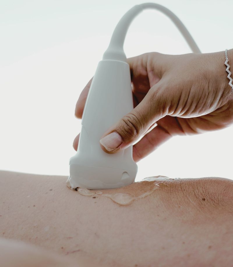 Tratamiento del linfedema en pacientes oncológicos con enfoque multidisciplinar