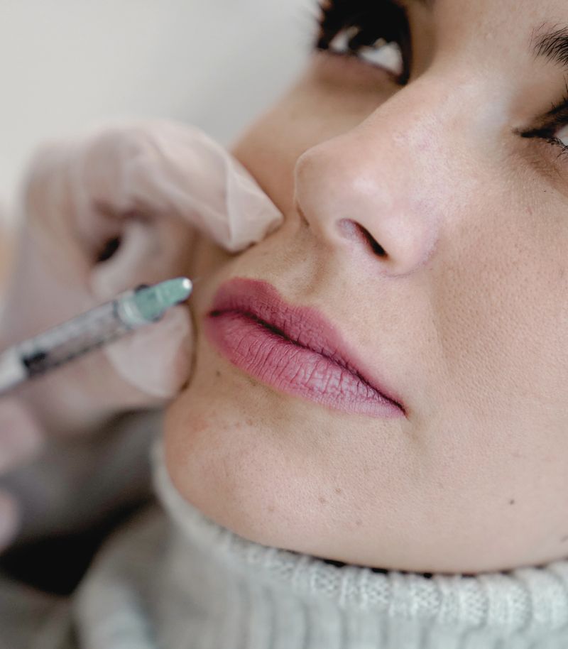 Técnica de Lip Flip para elevar sutilmente el labio superior sin aumentar volumen Técnica de Lip Flip para elevar sutilmente el labio superior sin aumentar volumen