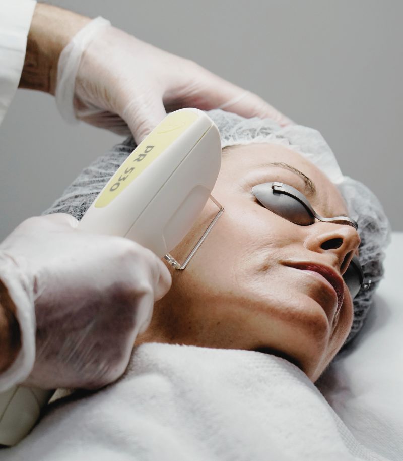 IPL para tratar rojeces, poros y tono desigual en tratamientos dermatológicos IPL para tratar rojeces, poros y tono desigual en tratamientos dermatológicos