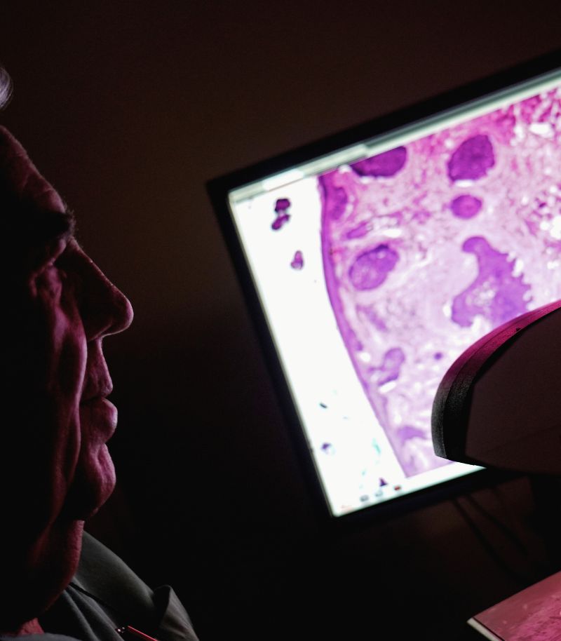 Abordaje especializado de melanomas avanzados con cirugía y terapias complementarias Abordaje especializado de melanomas avanzados con cirugía y terapias complementarias