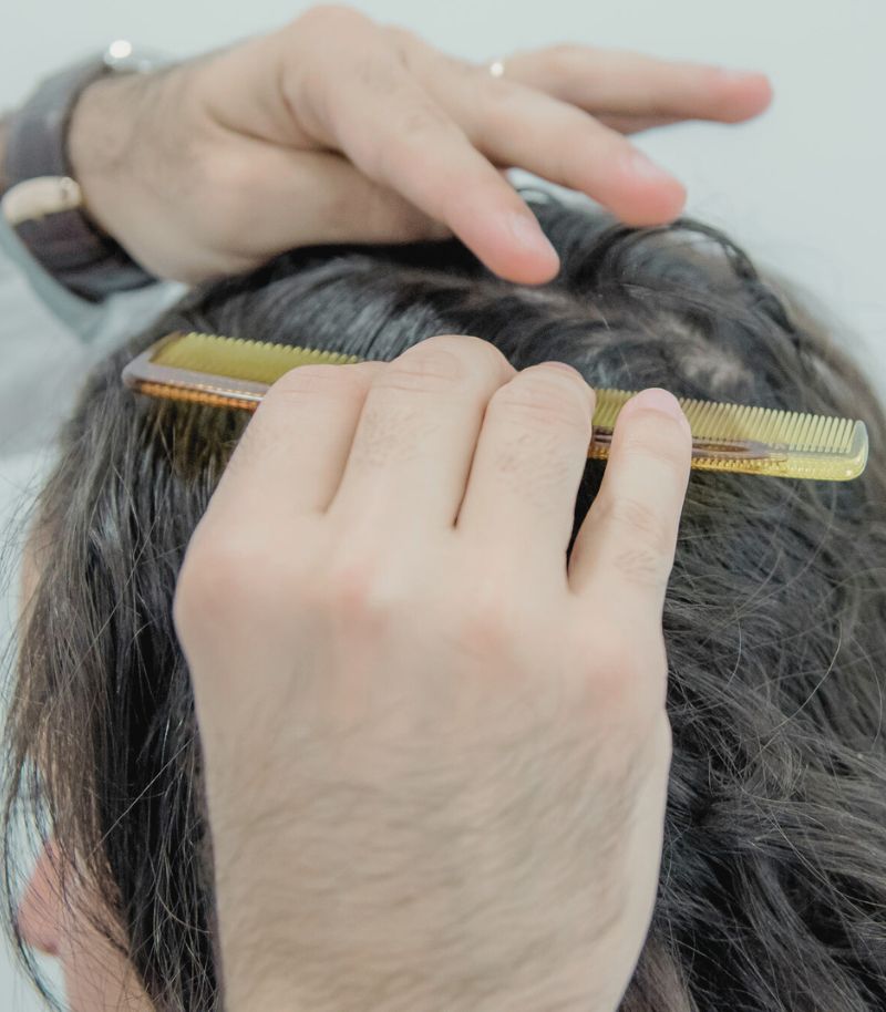 Resultados duraderos y precisos con técnica avanzada de micropigmentación capilar Resultados duraderos y precisos con técnica avanzada de micropigmentación capilar