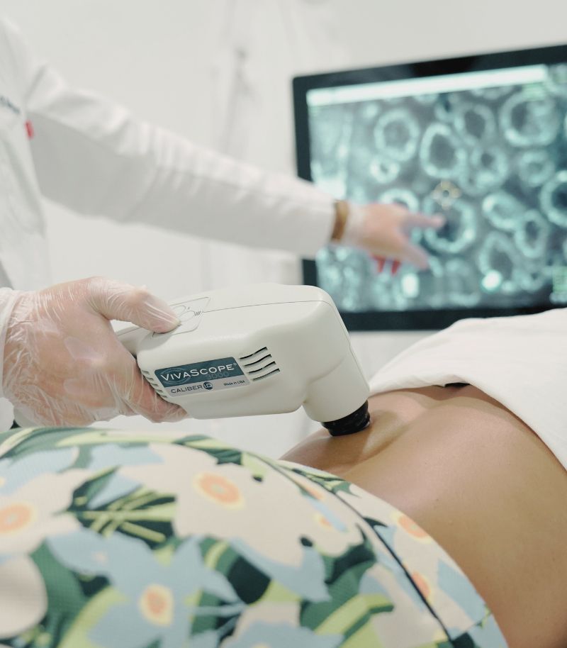 Real-time diagnosis without the need for a biopsy using confocal microscopy Real-time diagnosis without the need for a biopsy using confocal microscopy