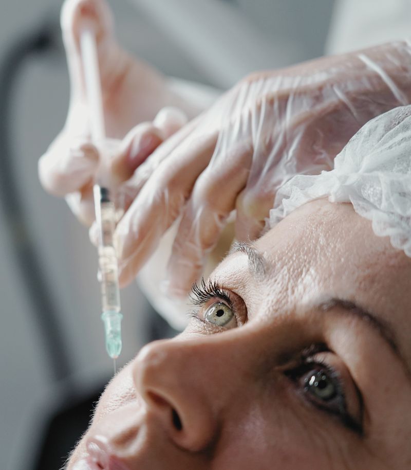 Preventive use of neuromodulators to slow the development of early expression lines