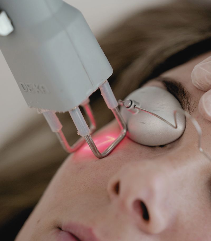 Tratamiento específico de ojeras según su origen: vascular, pigmentario o estructural Tratamiento específico de ojeras según su origen: vascular, pigmentario o estructural