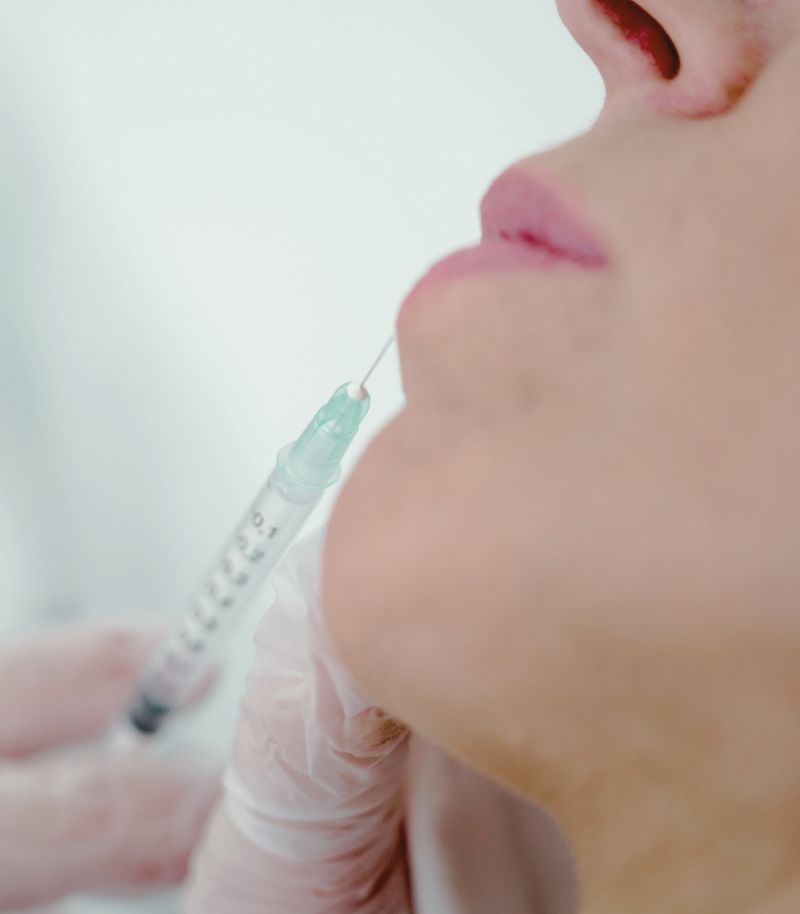 Definición estética del contorno labial con técnicas personalizadas Definición estética del contorno labial con técnicas personalizadas