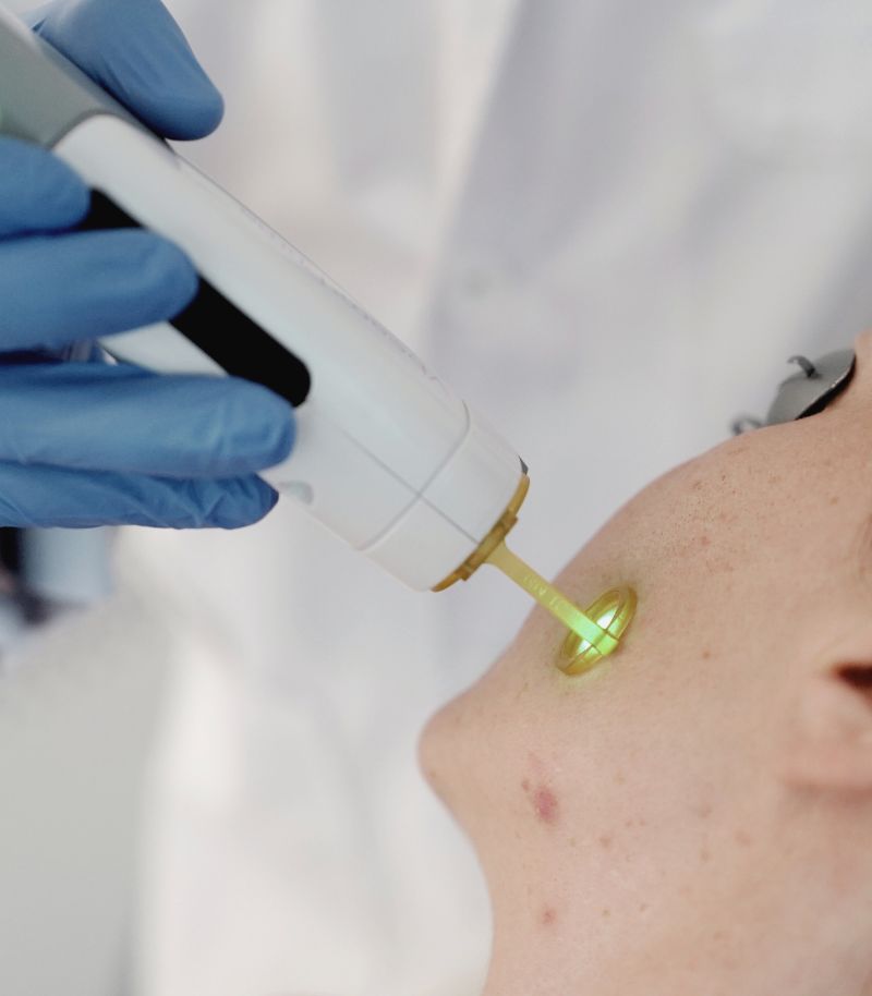 Prevención y tratamiento de brotes en pacientes con piel sensible Prevención y tratamiento de brotes en pacientes con piel sensible