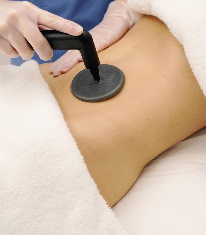 Radiofrecuencia médica para mejorar la firmeza y elasticidad de la piel