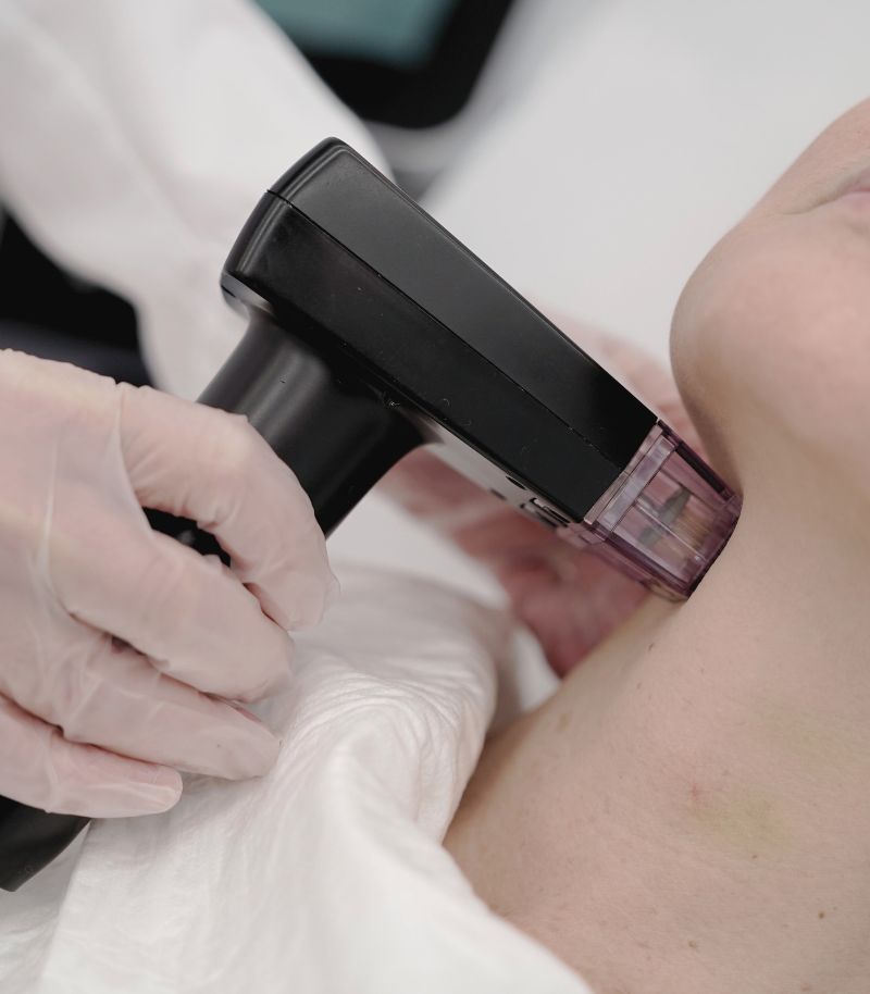 Tratamiento eficaz contra la flacidez con estimulación profunda de colágeno y elastina Tratamiento eficaz contra la flacidez con estimulación profunda de colágeno y elastina