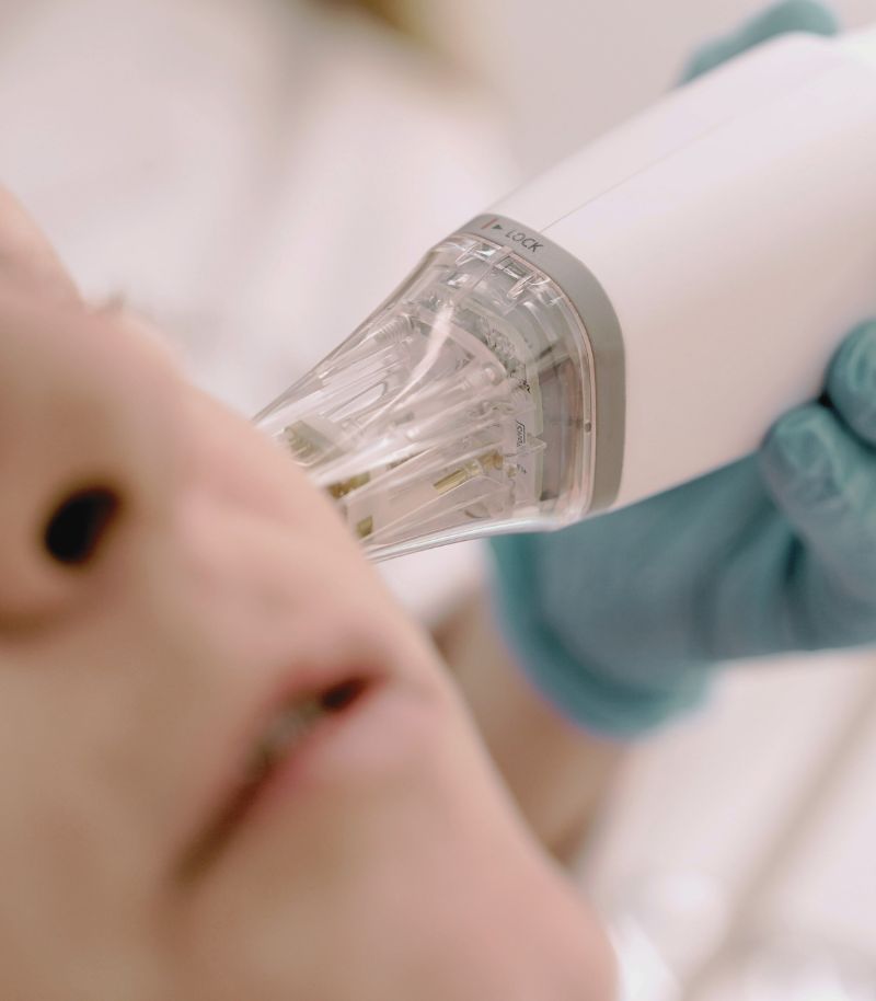 Radiofrecuencia con microagujas: tratamiento seguro y preciso para rejuvenecer sin cicatrices Radiofrecuencia con microagujas: tratamiento seguro y preciso para rejuvenecer sin cicatrices