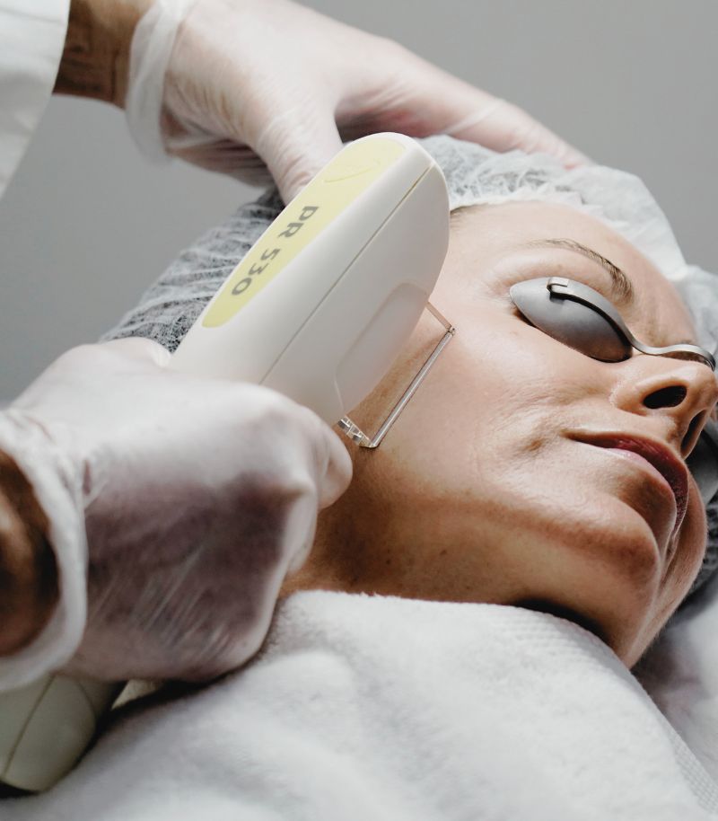 Luz pulsada intensa (IPL) para mejorar el tono y la uniformidad del rostro Luz pulsada intensa (IPL) para mejorar el tono y la uniformidad del rostro