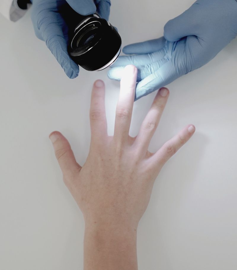 Tratamientos especializados para onicomicosis y uñas quebradizas Tratamientos especializados para onicomicosis y uñas quebradizas