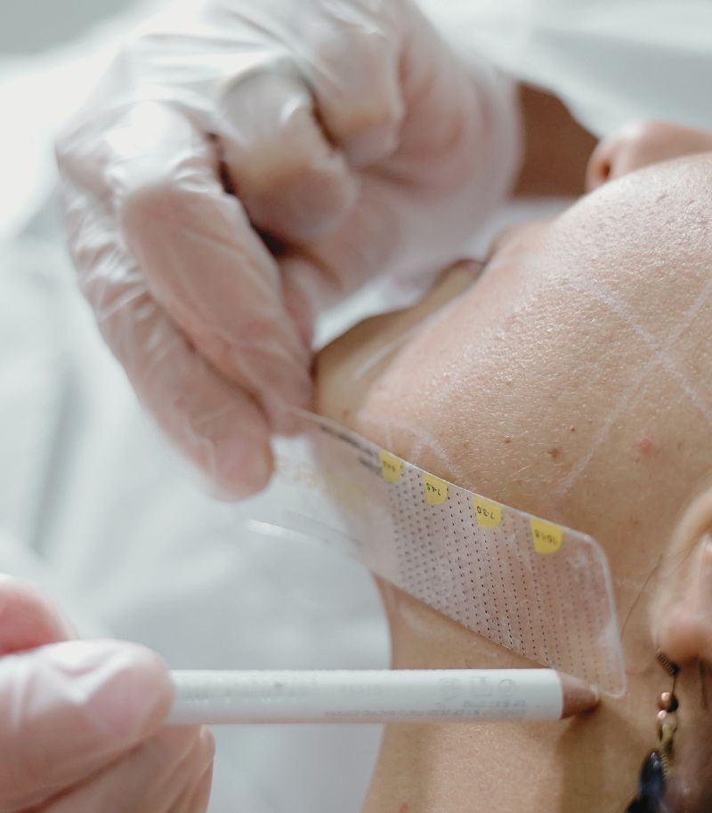 Tensado cutáneo personalizado con resultados naturales y protocolos adaptados