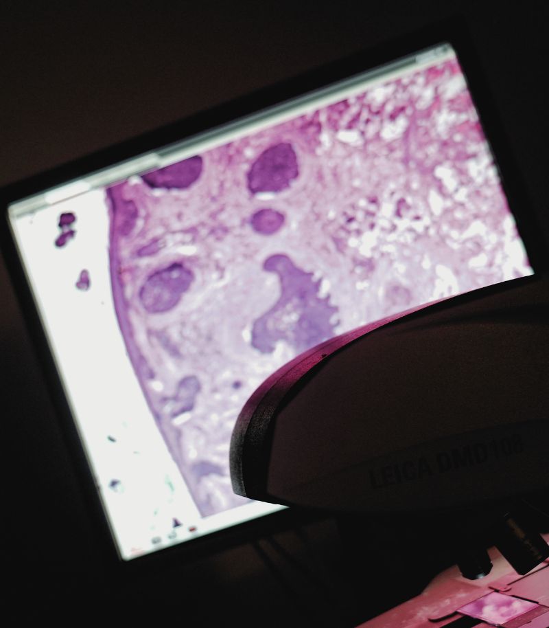 Specialists in the treatment of complex skin cancer using a multidisciplinary approach Specialists in the treatment of complex skin cancer using a multidisciplinary approach