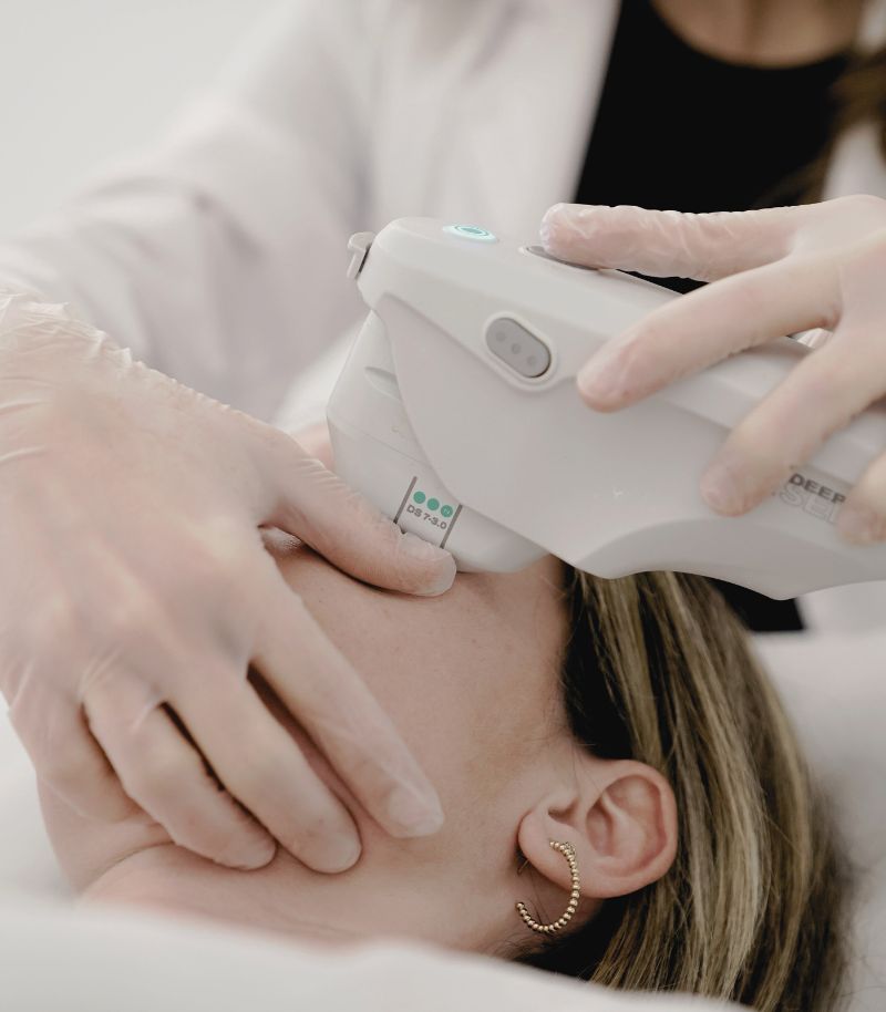 Ultrasonidos focalizados Ultherapy para lifting sin cirugía Ultrasonidos focalizados Ultherapy para lifting sin cirugía