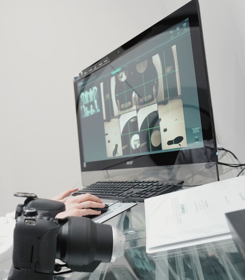 Planificación de intervenciones dermatológicas con imágenes 3D de alta precisión