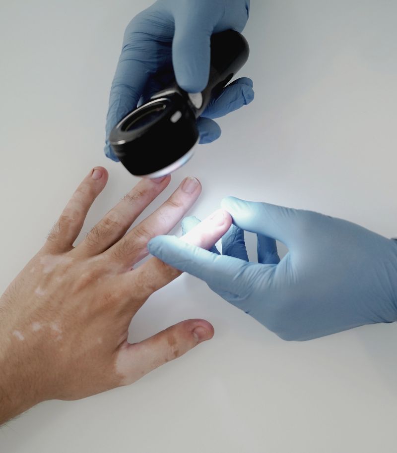 Psychological support for patients with chronic dermatological conditions Psychological support for patients with chronic dermatological conditions