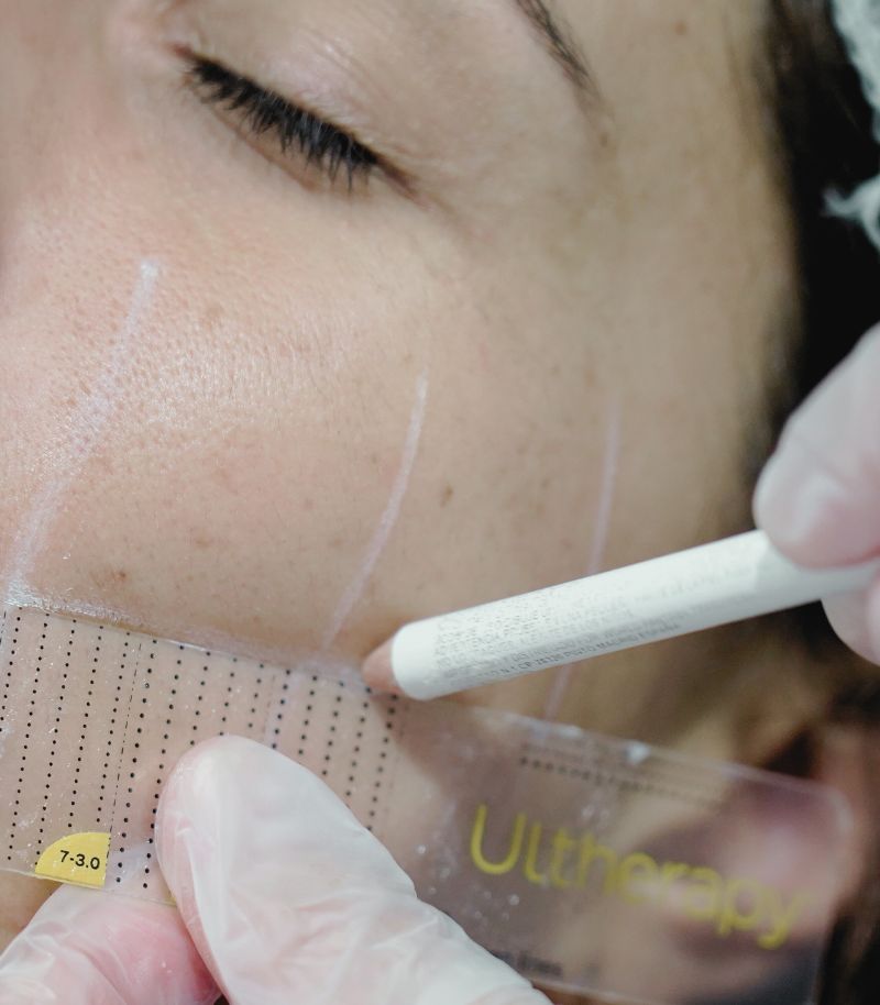 Enfoque integral para tratar la parálisis facial desde lo funcional hasta lo emocional Enfoque integral para tratar la parálisis facial desde lo funcional hasta lo emocional