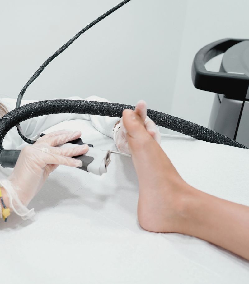 Eliminación de verrugas con ácido, crioterapia o láser CO2 según el caso Eliminación de verrugas con ácido, crioterapia o láser CO2 según el caso