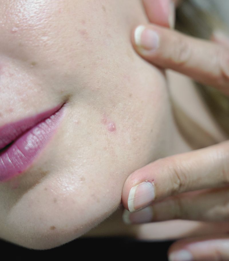 Dermatologist examining a patient’s face prior to Laser Me treatment