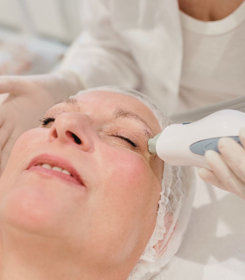 Tratamiento de radiofrecuencia para tensar la piel y mejorar el óvalo facial sin cirugía Tratamiento de radiofrecuencia para tensar la piel y mejorar el óvalo facial sin cirugía