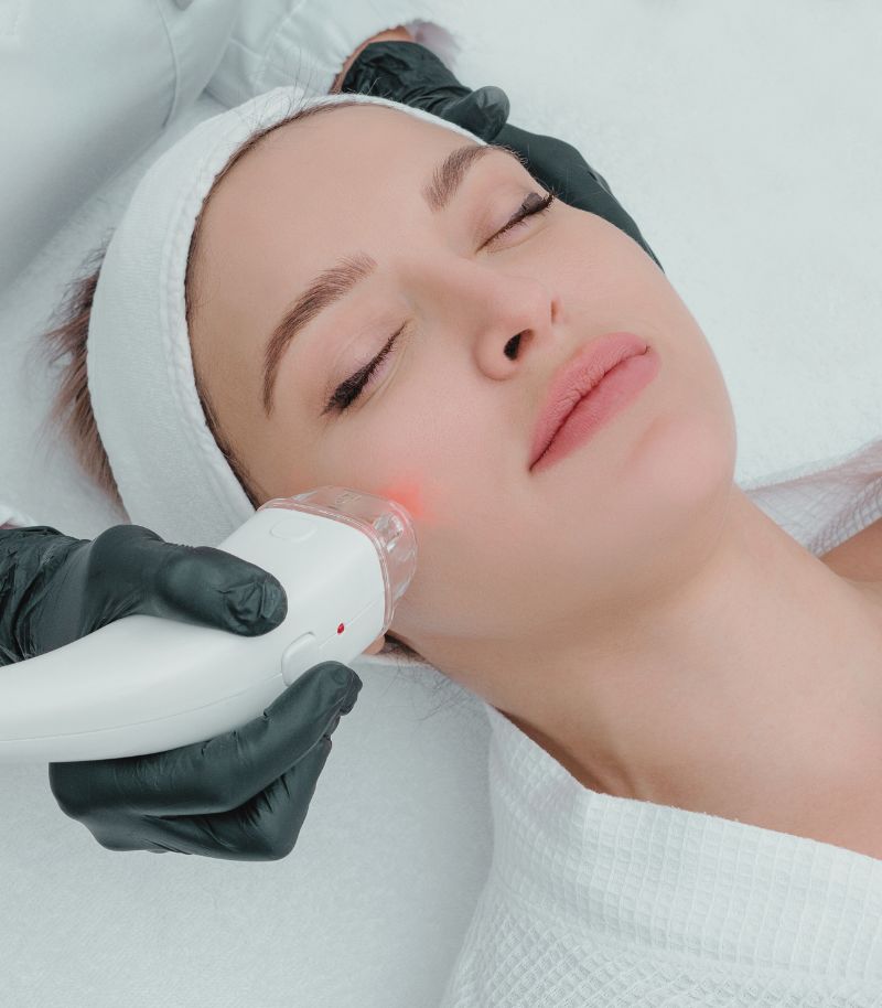Facial rejuvenation without damaging the skin Patient with luminous skin receiving Clear & Brilliant treatment for safe facial rejuvenation without skin damage
