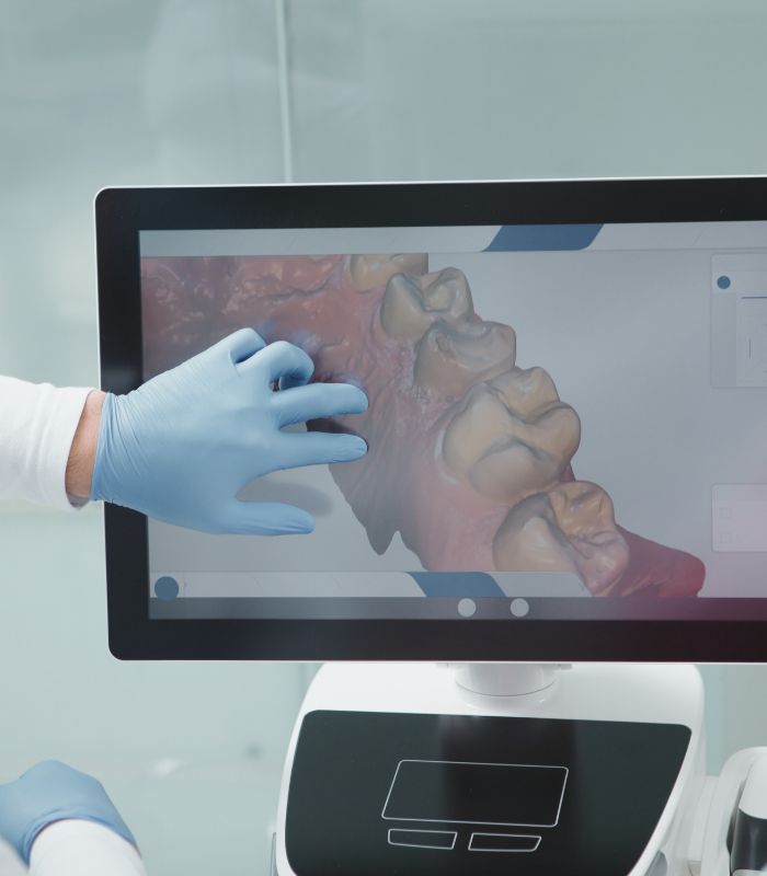 Escáner intraoral y modelos 3D para planificar intervenciones maxilofaciales con precisión