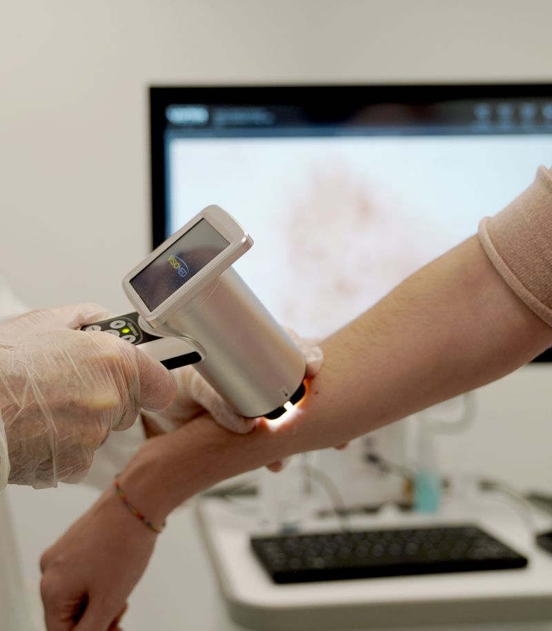 Personalised monitoring of high-risk skin cancer patients