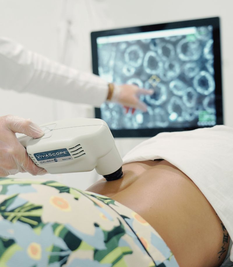 Confocal microscopy – virtual skin biopsy Confocal microscopy – virtual skin biopsy