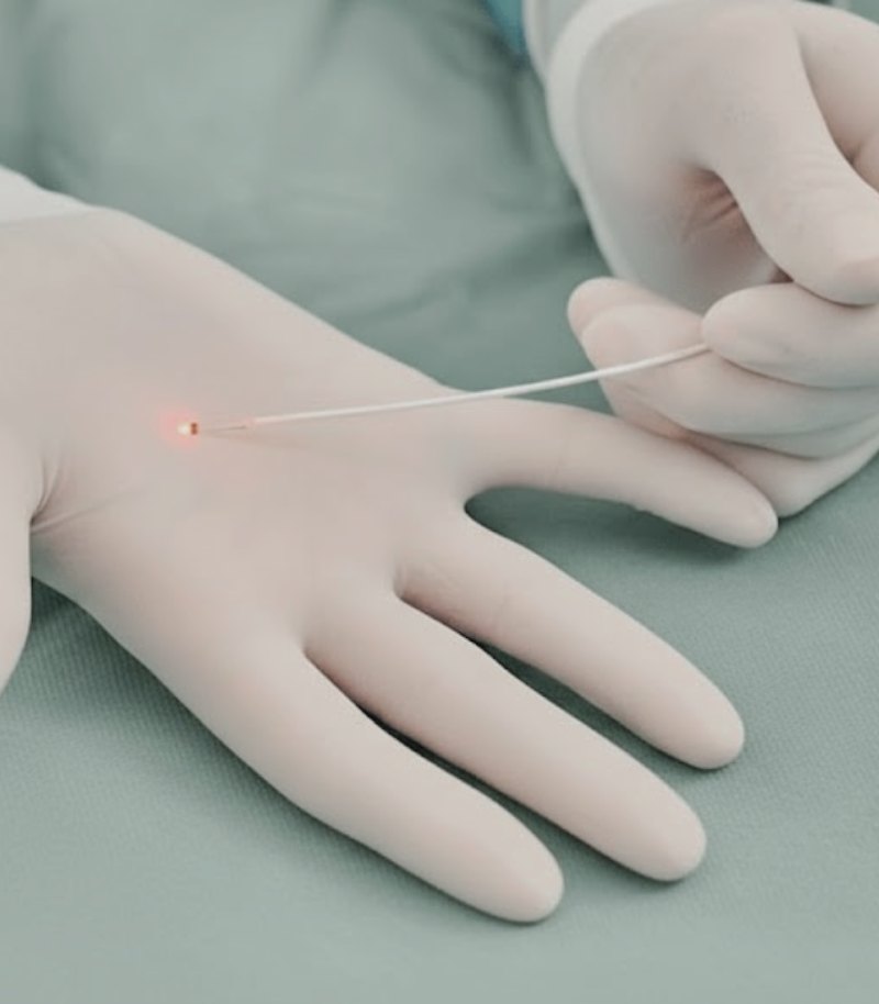 Técnica FILAC para la intervención de fístulas causadas por hidradenitis supurativa Técnica FILAC para la intervención de fístulas causadas por hidradenitis supurativa