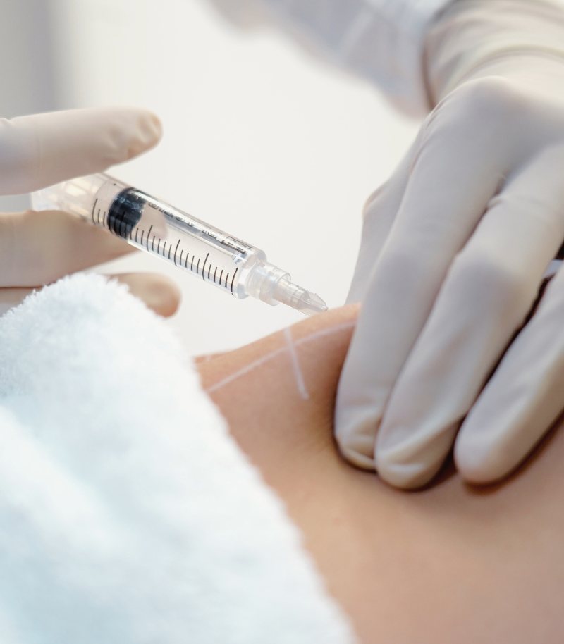 Liposucción asistida por agua (WAS) para una intervención menos invasiva y más precisa Liposucción asistida por agua (WAS) para una intervención menos invasiva y más precisa