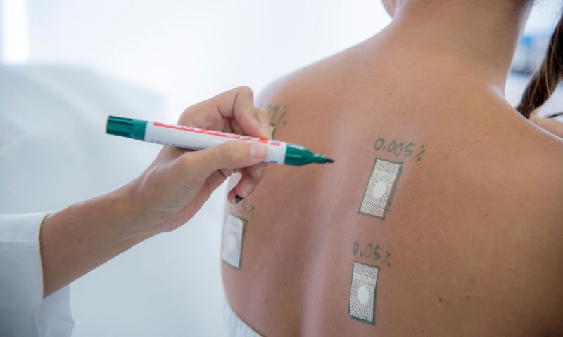 Dermatólogos especialistas en el tratamiento de la dermatitis de contacto en Madrid - Clínicas en Calle Serrano y La Moraleja. Dermatólogos especialistas en el tratamiento de la dermatitis de contacto en Madrid - Clínicas en Calle Serrano y La Moraleja.
