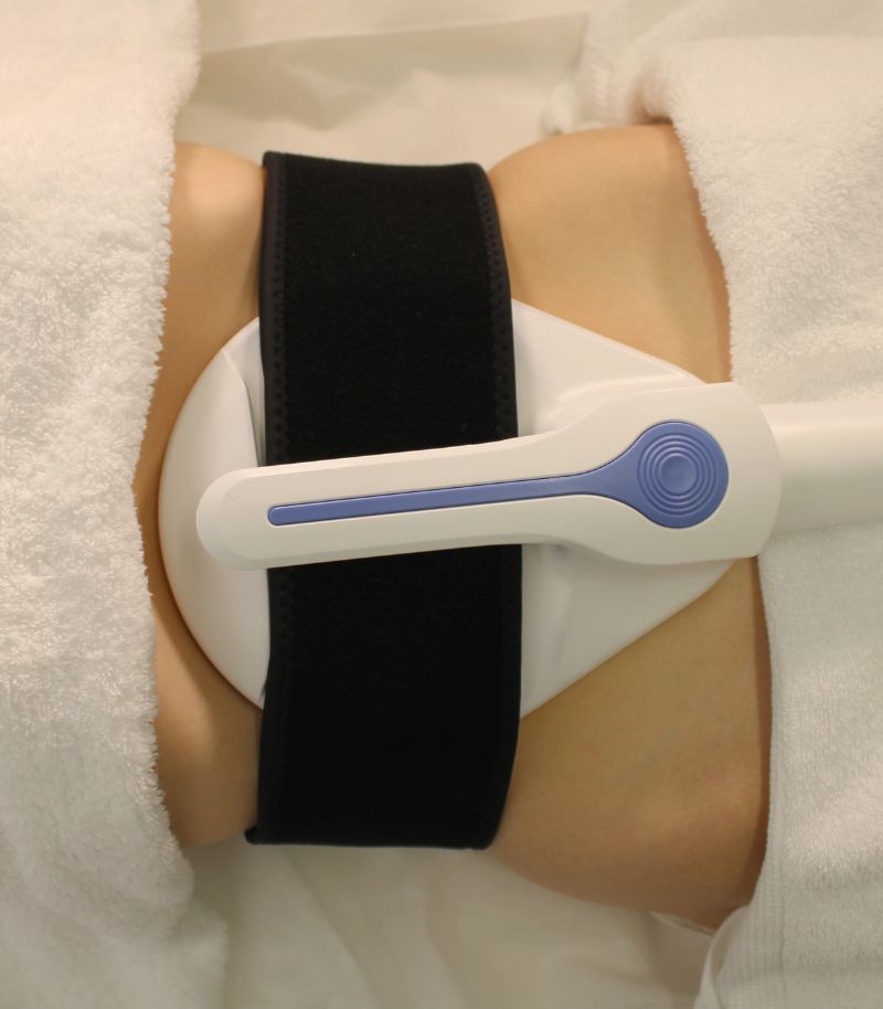 Electroestimulación muscular